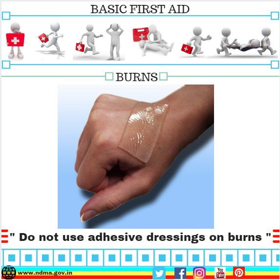 Don’t use adhesive dressings on burns
